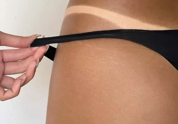 Close-up of bikini tan line on hip
